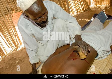 Während die traditionelle Medizin ‘sSudan noch immer im Land herrscht, sind ein bekannter Teil der Kultur „spirituelle Heiler“, die einst als ‘„Hexenärzte“ bekannt waren. Stockfoto