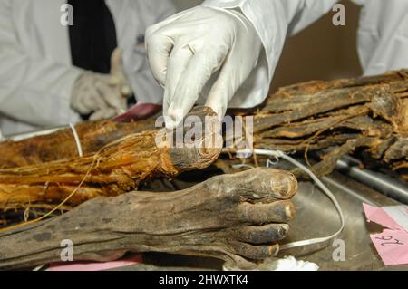 Medizinstudenten untersuchen die Sehnen von der vorderen Seite des Fußes in eine anatomische Probe. Stockfoto