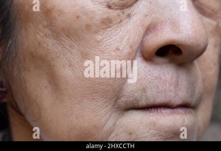 Vergrößerte Poren im Gesicht der südostasiatischen, chinesischen älteren Frau mit Hautfalten. Stockfoto