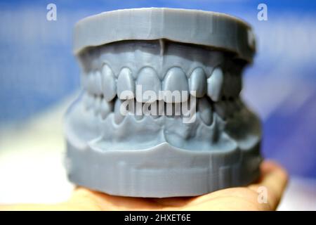 Ober- und Unterkiefer eines Mannes, der auf einem 3d-Drucker aus Photopolymer gedruckt wurde. Stockfoto