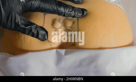 Bruch des Steißbeins der Wirbelsäule. Externe ärztliche Untersuchung durch einen Arzt. Die Hände mit Handschuhen zeigen ein Trauma. Kreuzbein und Steißbein ragen hervor und sind deutlich sichtbar. Stockfoto