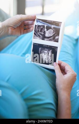 Babys erstes Foto. Aufnahme einer nicht identifizierbaren Schwangeren, die ein Sonogramm hält, während sie sich zu Hause entspannt. Stockfoto