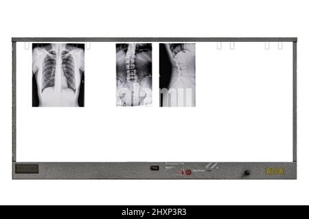 Röntgenfilm-Viewer isoliert auf weißem Hintergrund 3D Abbildung Stockfoto