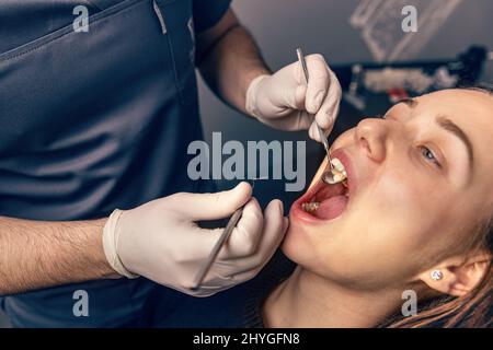 Junge Frau, die ihre Zähne während eines Termins in der Zahnklinik vom Zahnarzt überprüfen lassen. Stockfoto