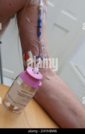 Mann, der mit Natriumchlorid Fluorouracil cytotoxic Drug für kontinuierliche intravenöse Infusion Chemotherapie Medikamente zu Hause durch Picc L behandelt wird Stockfoto