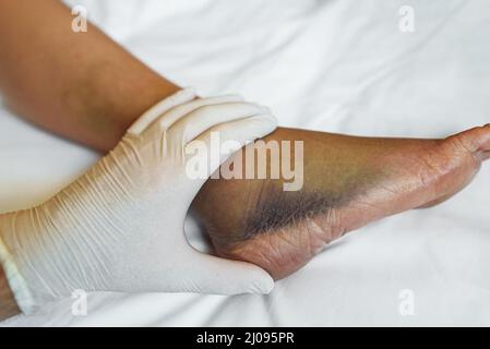 Der Arzt tastet das verletzte Bein des Patienten auf. Stockfoto