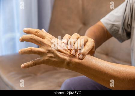 Ältere Männer, die an Gelenkschmerzen mit Gicht-Entzündung leiden Stockfoto