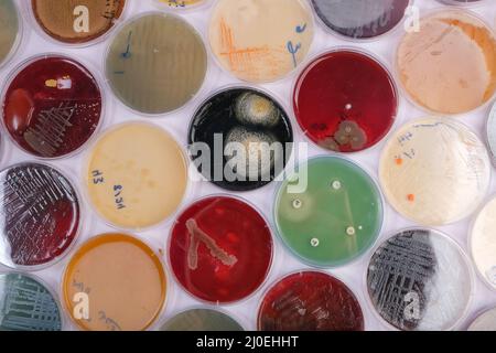 Die Sammlung von Kulturplatten enthält das Wachstum von Mikroorganismen auf verschiedenen Agarmedien Stockfoto