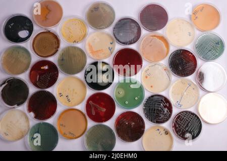 Die Sammlung von Kulturplatten enthält das Wachstum von Mikroorganismen auf verschiedenen Agarmedien Stockfoto