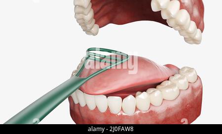 Zungenreinigung, Abbildung Stockfoto