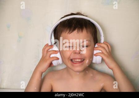 Porträt eines glücklichen lächelnden Kindes mit Windpocken, die Ohrhörer tragen. Kleinkind mit roten juckenden Pickel am ganzen Körper hört Musik oder Hörspiel Stockfoto