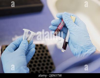 Nahaufnahme Arzt hält Schlauch mit Blut Stockfoto