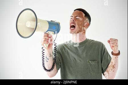 Sprechen Sie, auch wenn Ihre Stimme zittert. Studioaufnahme eines jungen Mannes mit Vitiligo mit einem Megaphon vor weißem Hintergrund. Stockfoto