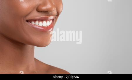 Zahnärztliche Werbung. Nahaufnahme Des Schönen Lächelns Der Jungen Schwarzen Frau Stockfoto