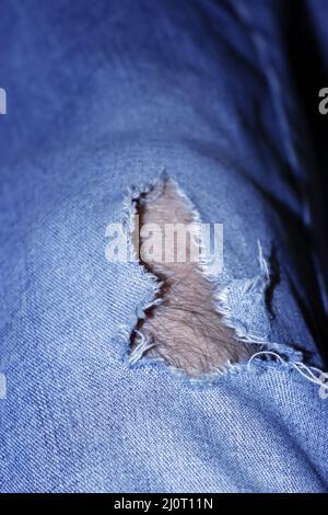 Loch in blaue Jeans, unter dem Bein eines haarigen Mannes Stockfoto