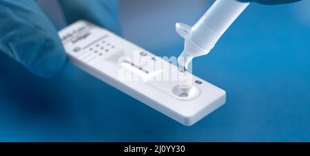 Corona-Virus-Antigen-Schnelltest. Testkit für Laborkarten für COVID-19. Stockfoto