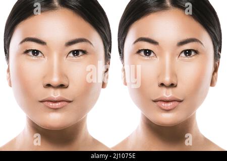 Transformation der asiatischen Frau. Ergebnis einer plastischen Operation. Stockfoto