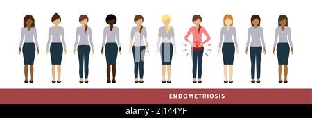 Eine von zehn Frauen hat Endometriose Illustration von verschiedenen Frauen eine mit Bauchschmerzen Stock Vektor