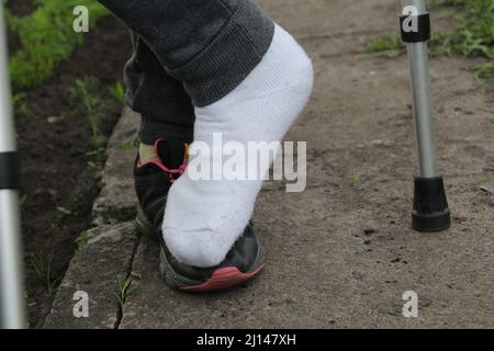 Ein Mädchen mit gebrochenem Fingerbein. Gesundheit Menschen mit Behinderungen. Stockfoto