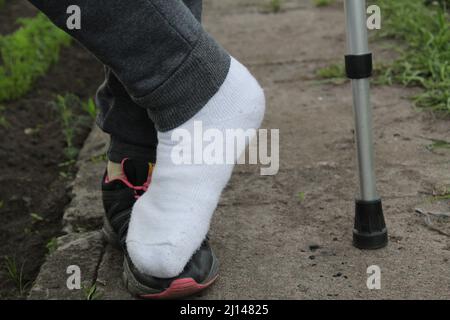 Ein Mädchen mit gebrochenem Fingerbein. Gesundheit Menschen mit Behinderungen. Stockfoto