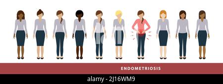 Eine von zehn Frauen hat Endometriose Illustration von verschiedenen Frauen eine mit Bauchschmerzen Stock Vektor