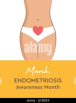 Infografik zum Monat des nationalen Bekanntheitsgrades für Endometriose Stock Vektor