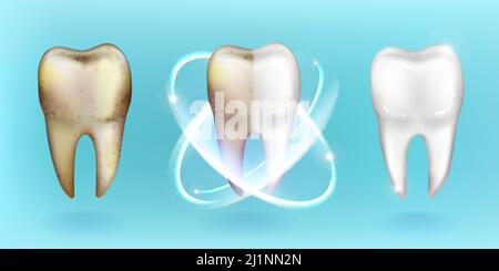 Saubere und schmutzige Zähne, Bleaching und Clearing Zähne Prozess. Zahn-und Mundhöhle Gesundheitsversorgung, Zahnschmelzrestaurierung, Zahnpasta Werbung isoliert o Stock Vektor