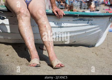 Die Beine einer alten Frau, die in der Sonne auf einem kleinen Boot sitzt und die Wärme auf ihrer Haut am Strand in Sestri Levante, Italien, genießt. Stockfoto