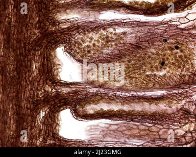 Längsschnitt des Kegels der männlichen Kiefer (Pinus sylvestris), der Mikrosporangium und Pollen zeigt. Stockfoto