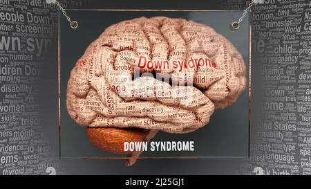 Down-Syndrom-Anatomie - seine Ursachen und Auswirkungen auf ein menschliches Gehirn projiziert, die Down-Syndrom-Komplexität und Beziehung zum menschlichen Geist aufdecken. Konzeptkunst, Stockfoto