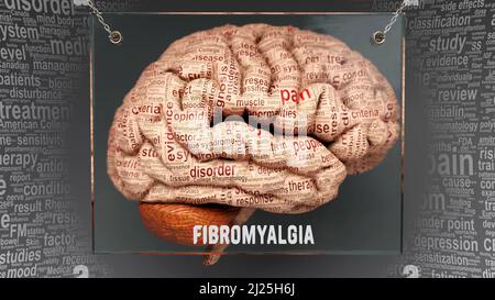 Fibromyalgie Anatomie - seine Ursachen und Auswirkungen auf ein menschliches Gehirn projiziert enthüllt Fibromyalgie Komplexität und Beziehung zum menschlichen Geist. Konzeptkunst, 3D Stockfoto