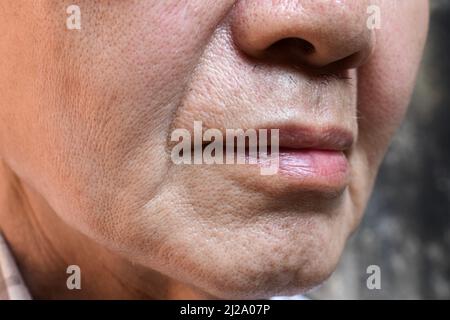 Vergrößerte Poren im Gesicht des südostasiatischen, chinesischen älteren Mannes mit Hautfalten. Stockfoto