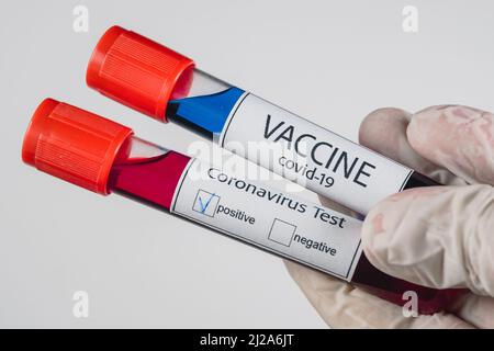 Vakuumröhrchen mit einer Blutprobe mit einem positiven Ergebnis für eine Covid-19-Infektion und einer blauen Impfstoffprobe Stockfoto