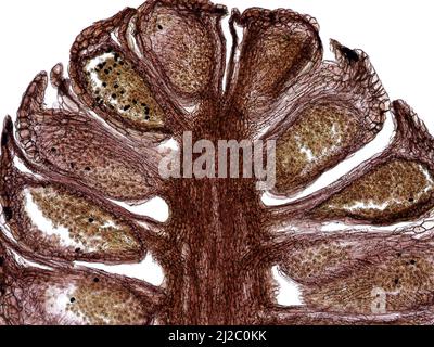 Längsschnitt des männlichen Kiefernzapfens (Pinus sylvestris) unter Mikroskop mit Mikrosporangium mit Pollenkörnern. Histologische Struktur. Stockfoto