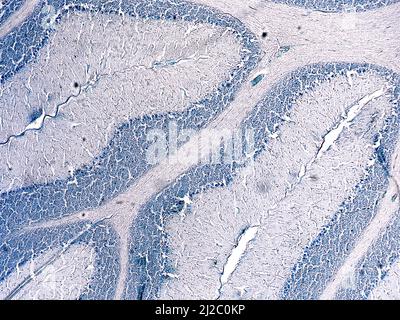 Querschnitt eines Zerebellums. Purkinje-Zellen. Leichte Mikrograph. Cresyl-Violette Färbung (Nissl-Färbung). Stockfoto