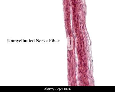 Ein Interessantes Foto, das mit einem Mikroskop aufgenommen wurde. Unmyelinierte Fasern in peripheren Nerven. Längsschnitt. Hematoxylin und Eosin Stainit. Stockfoto