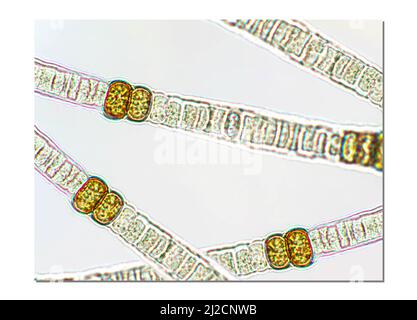 Nodularia sp. Giftige Algen unter mikroskopischer Ansicht x100 Stockfoto