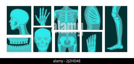 Röntgenbilder von menschlichen Körperteilen Vektorgrafiken. Knochen des Skeletts, Wurzelwerk von Kopf, Brust, Hand, Bein, Röntgenaufnahmen von Knie und Fuß, isoliert auf weißem Ba Stock Vektor