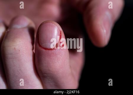 Messer schneiden Finger blutende Makro blutige Finger Scheibe. Stockfoto