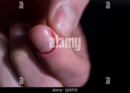 Zerschnittener Finger Blutung Nahaufnahme Fingerverletzung. Offene Wunde vom Messer, der an der Fingerspitze geschnitten wurde. Stockfoto