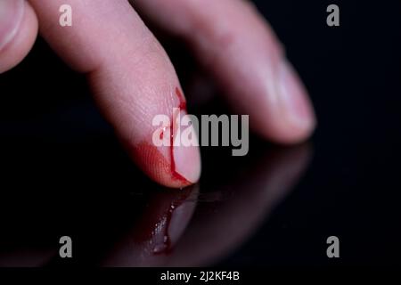 Schneiden Sie die Finger bluten Fingerverletzung nach Messer Unfall. Stockfoto