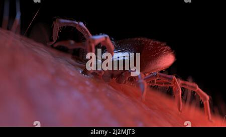 Tick beißt menschliche Haut, Illustration Stockfoto
