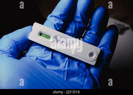Covid-19-Kassette mit positivem Ergebnis aus einem Schnellantigen-Testkit, das von medizinischem Personal verwendet wurde Stockfoto