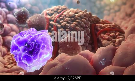 Die T-Zellen töten Krebszellen ab. Sie zerstören zusätzlich das Blutgefäßsystem des Tumors und ...