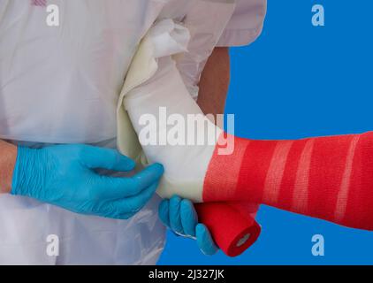 Niederlande, eine Schiene wird verwendet, um ein gebrochenes Bein zu heilen. Eine Schiene ist definiert als „ein starres oder flexibles Gerät, das einen verdrängten oder beweglichen Stab in Position hält Stockfoto
