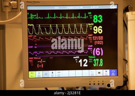 Niederlande, ein Patientenmonitor im Krankenhaus, der die Herzfrequenz, das Blut und den Sauerstoff zeigt. Stockfoto