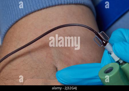 Der Arzt Blut in einer Spritze sammelt, Krankenschwester Blut aus den Venen am Arm Stockfoto