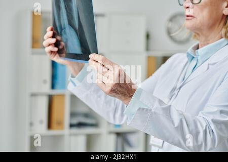 Hände eines reifen Radiologen in Whitecoat, der versucht, eine Diagnose für den Patienten zu erstellen, während er sich das Röntgenbild der Lunge in Kliniken ansieht Stockfoto