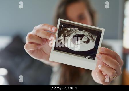 Schau dir meine kleine Erdnuss an. Aufnahme einer Frau mit einem Sonogramm ihres ungeborenen Babys. Stockfoto