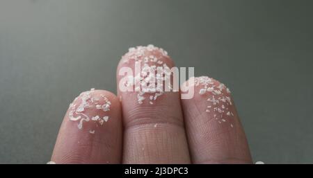 Nahaufnahme von Mikroplastik auf menschlichen Fingern. Konzept für Wasserverschmutzung und globale Erwärmung. Idee zum Klimawandel. Stockfoto